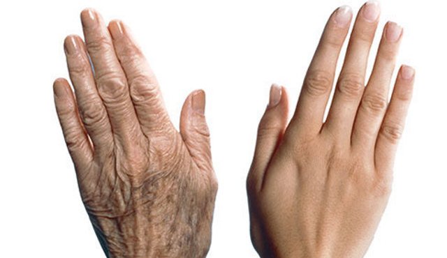  Как сделать руки моложе: способы обмануть возраст
