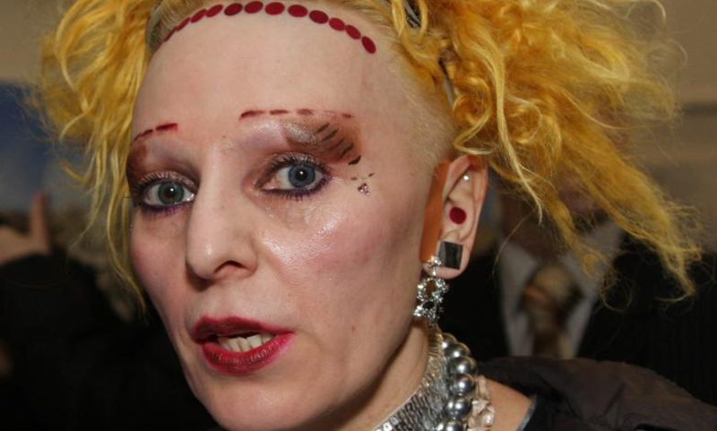  Совершенно другой человек: Жанна Агузарова потеряла свое лицо и превратилась в куклу