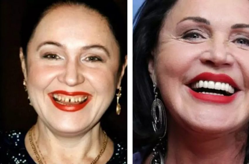  «Новая «голливудская» улыбка»: как выглядели звезды до того, как поставили виниры