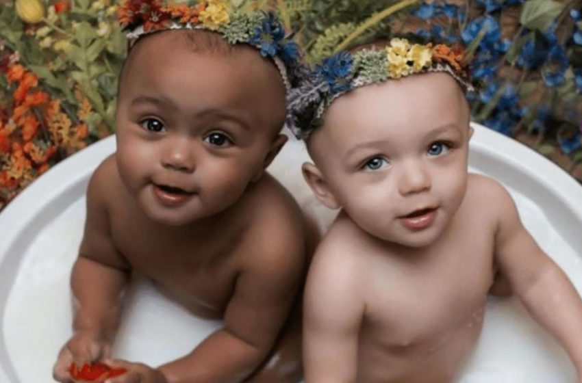  «Эти девочки-близнецы родились с разным цветом кожи»: они выросли и стали настоящими красотками