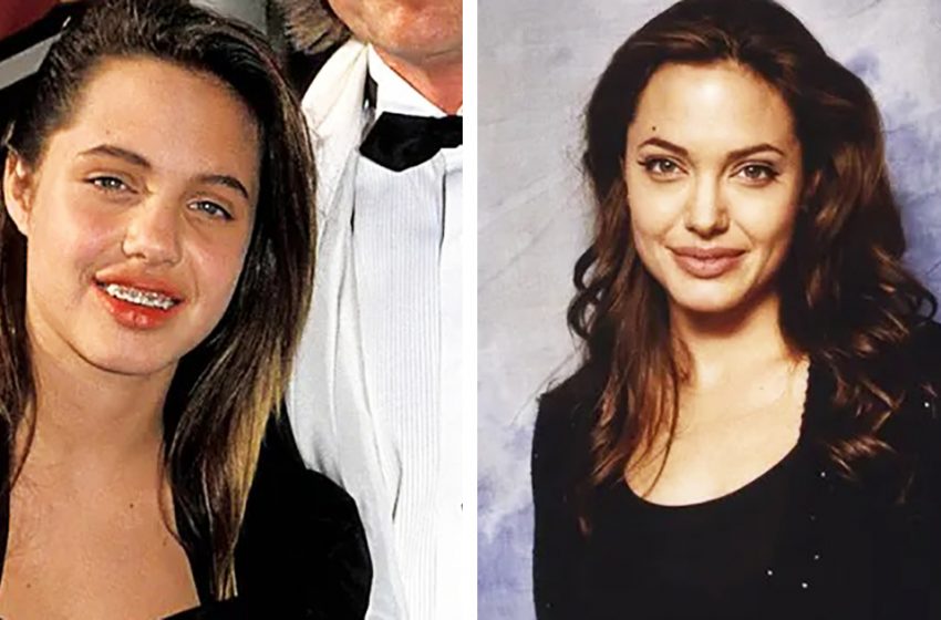  «Филлеры и ботокс»: пользователи Сети уличили Анджелину Джоли в пластике