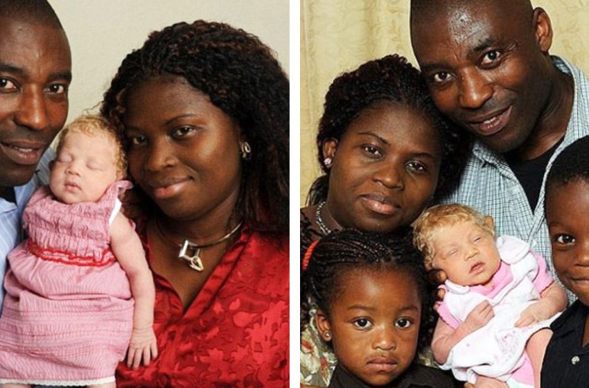 Как сегодня выглядит «Белоснежка», которая 10 лет назад появилась на свет в Нигерийской семье