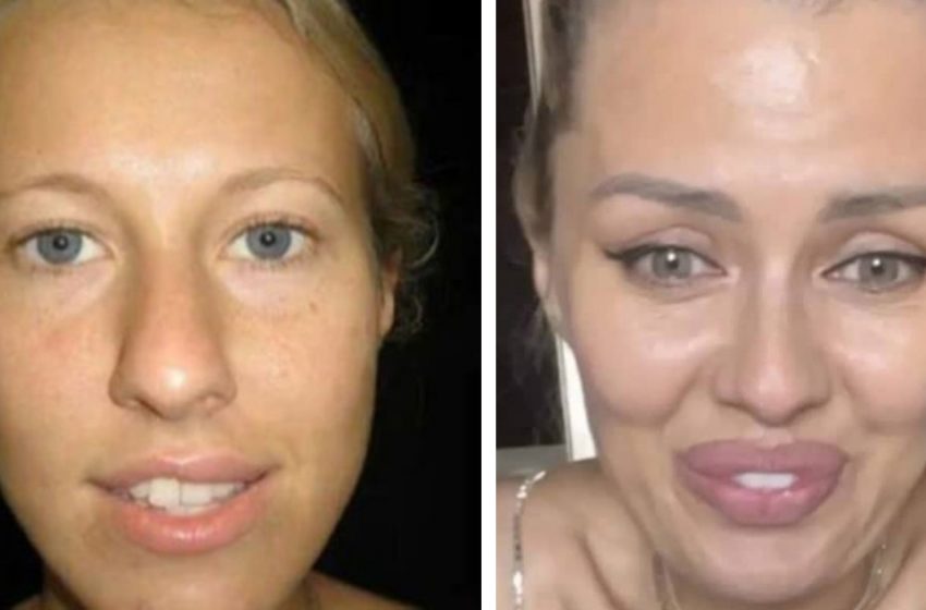  «Смелые красавицы»: знаменитости, которые решились показаться без макияжа и фильтров