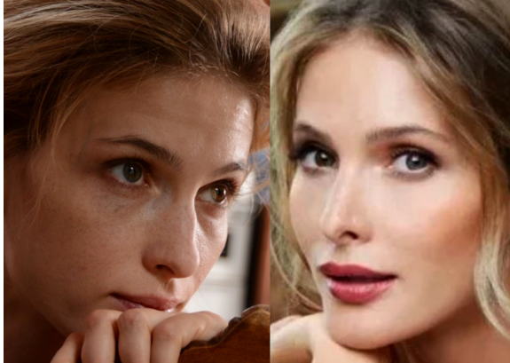 Светлана иванова до и после пластики носа фото