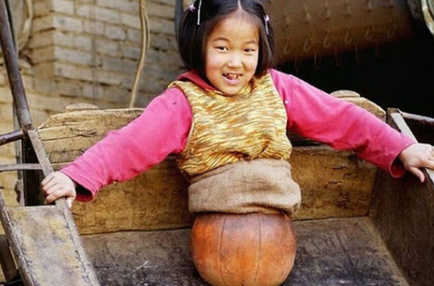  Вместо ног баскетбольный мяч и огромное упорство. Как живет девочка, лишившаяся конечностей из-за аварии?